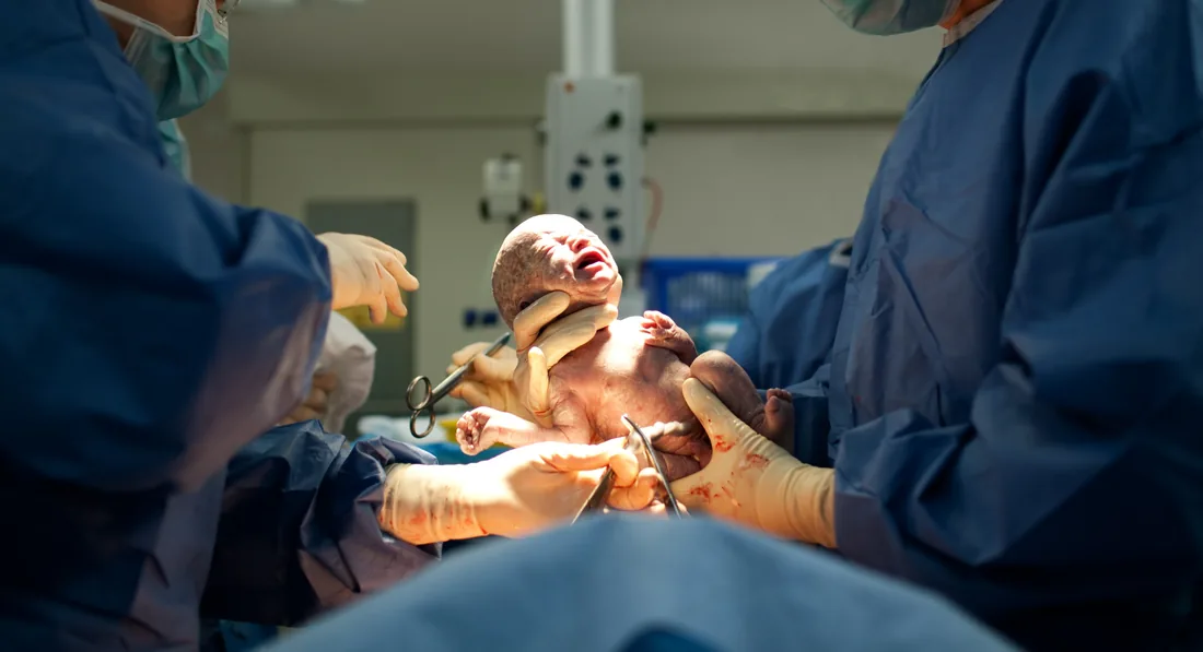 Normal Delivery & C-Section